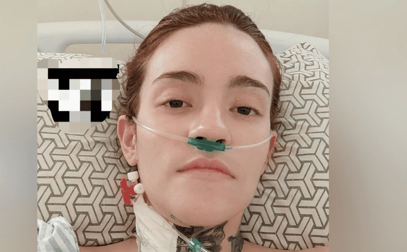Neuralgia do trigêmeo: 'pior dor do mundo' diminui após jovem passar por novo procedimento