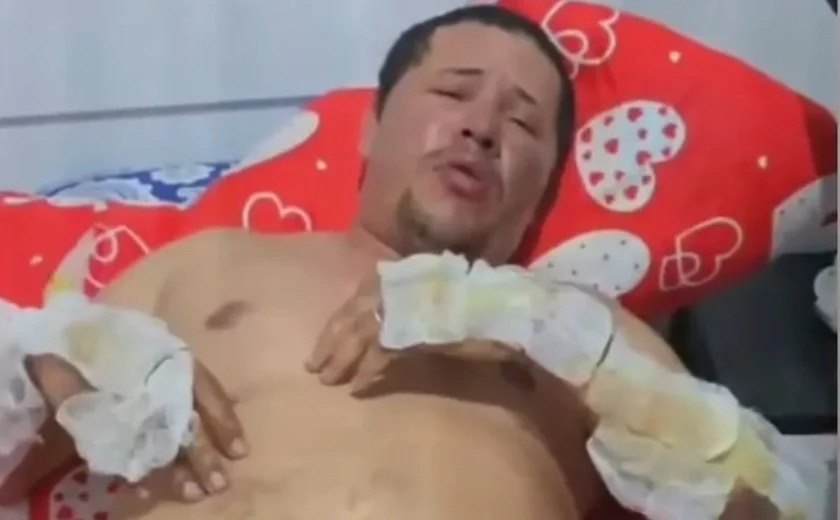 “Estou aqui por um milagre”, diz motorista de app sequestrado e queimado vivo em Maceió