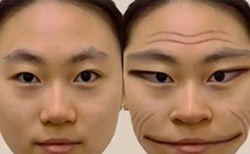'Síndrome da face demoníaca': o distúrbio tem cura? Veja o que dizem especialistas