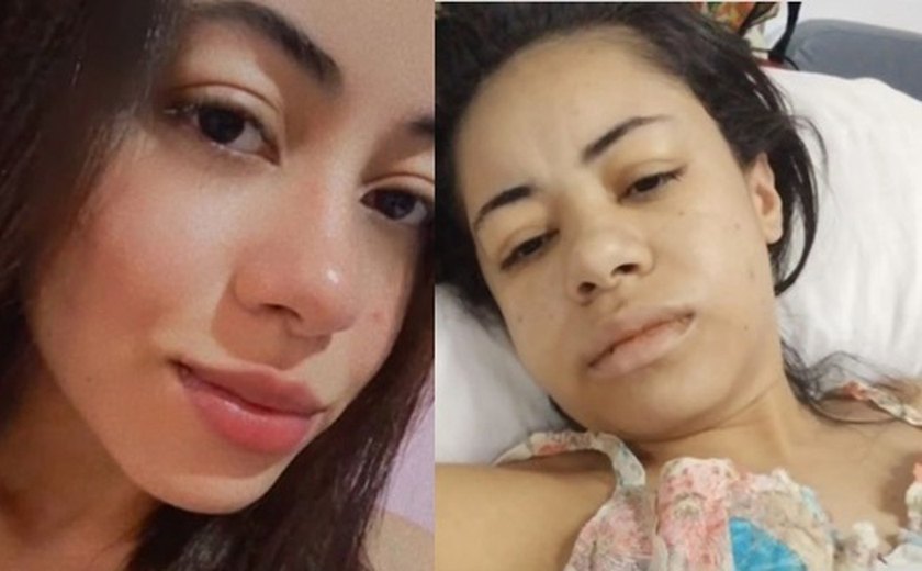 Jovem alagoana precisa de ajuda para custear tratamento de doença rara