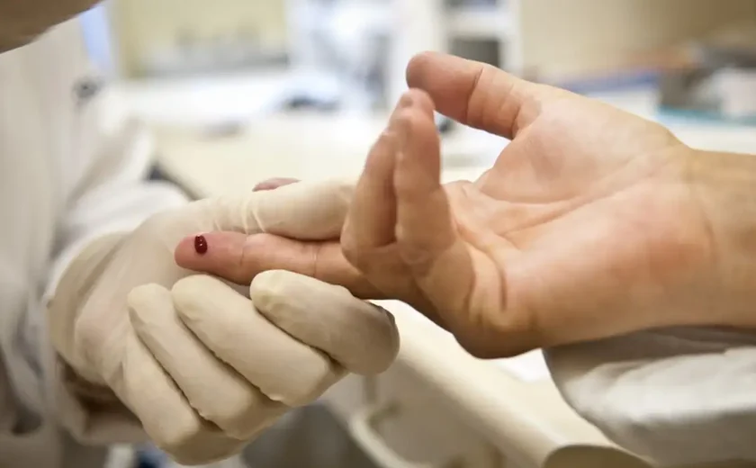 HIV: pesquisadores descobrem nova variante do vírus em circulação em 3 estados do Brasil