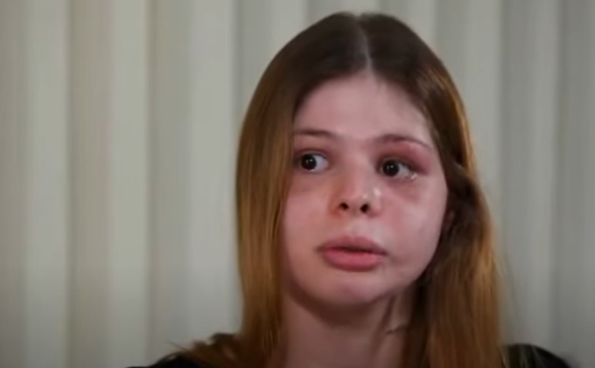 Médica que teve rosto desfigurado por fisiculturista diz que fingiu desmaio para não ser morta