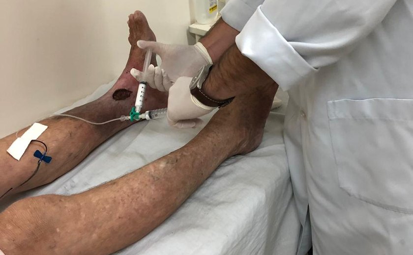 Prefeitura de Limoeiro de Anadia disponibiliza médico angiologista para a população