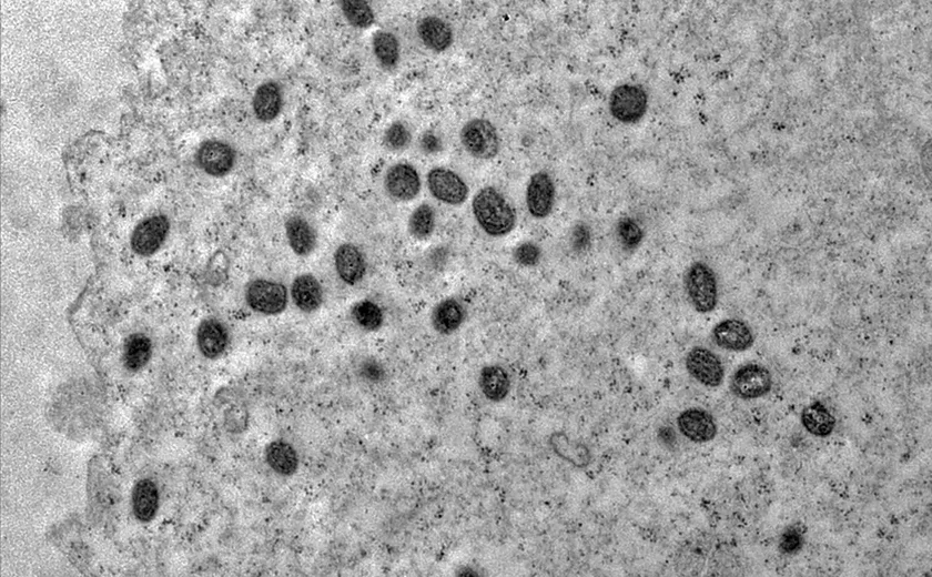 Mpox: Argentina põe em quarentena navio que deixou Brasil