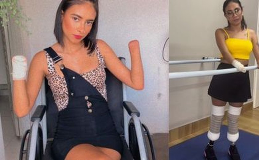 Jovem que teve mãos e pés amputados após quadro de infecção urinária compartilha processo de adaptação a próteses: 'Muito feliz'