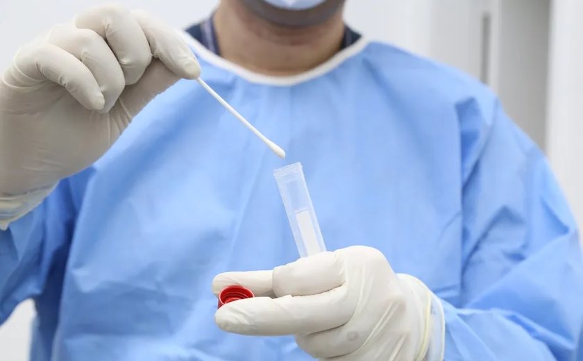 Anvisa aprova o registro do 1º teste para diagnóstico da varíola dos macacos