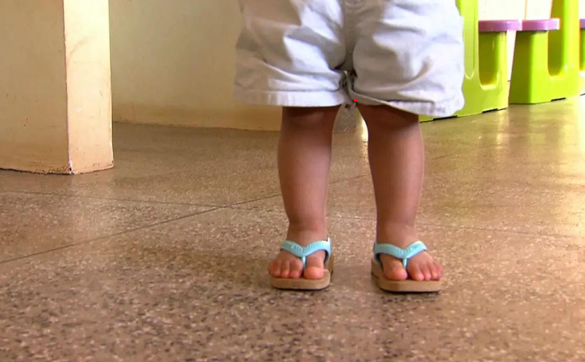 Perturbações cerebrais na infância podem levar a transtornos psiquiátricos na vida adulta, diz estudo brasileiro