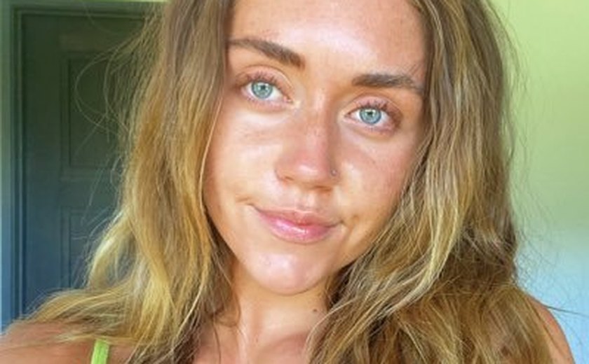 Mulher quase teve o pé amputado depois que um pequeno corte no dedo do pé apodreceu a carne