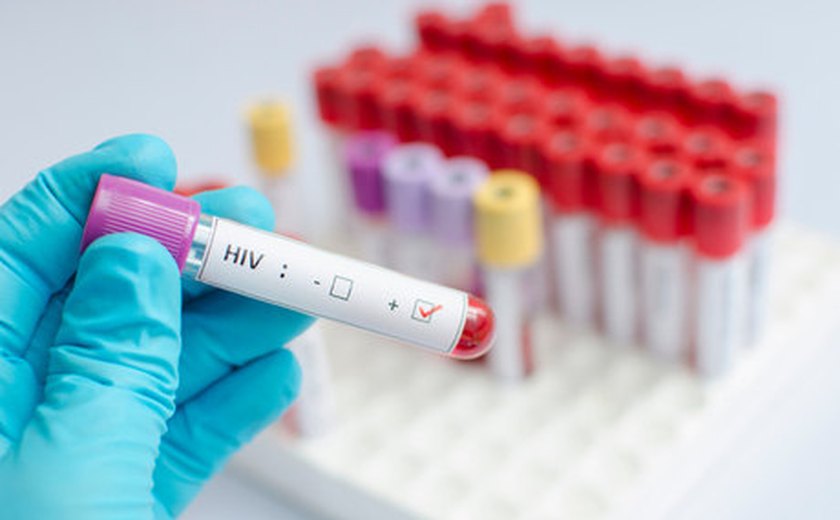Número de brasileiros com o vírus HIV ainda cresce no Brasil