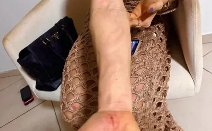 Governo do Estado afasta piloto aviador da Polícia Civil suspeito de agredir mulher em condomínio