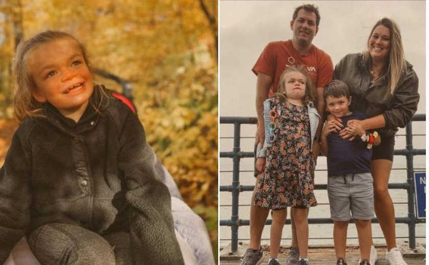 'Alzheimer infantil': 2 irmãos são diagnosticados com doença rara que reduz a expectativa de vida drasticamente