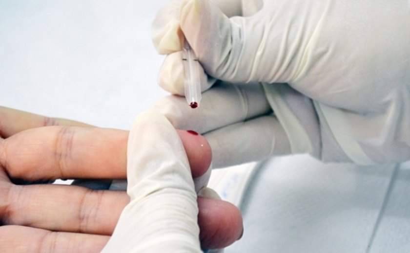 Hospital Helvio Auto fará testes para detectar HIV e sífilis abertos à população