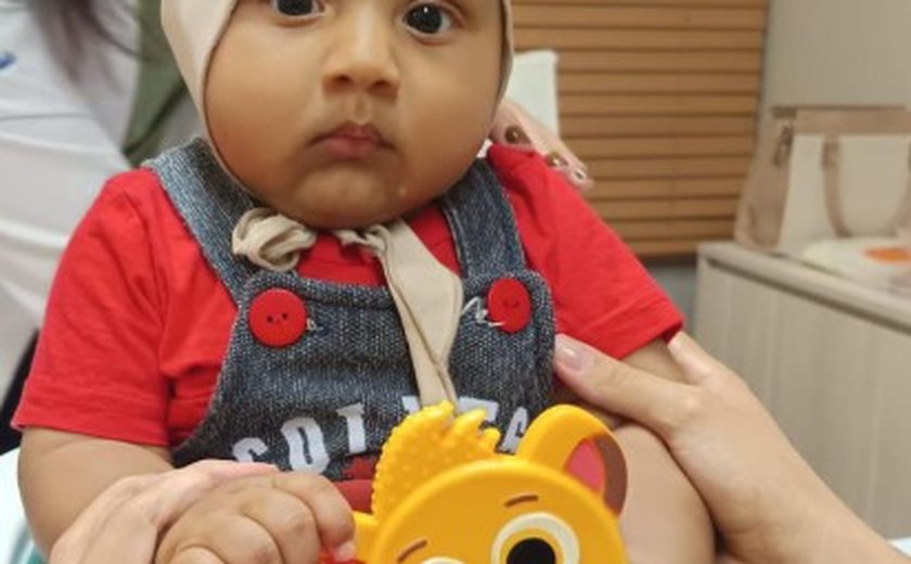 Pais de bebê com assemetria craniana lançam campanha para custear tratamento urgente