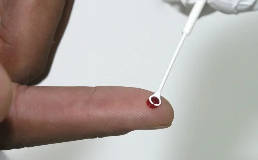 Saúde amplia vacinação contra o HPV para quem usa PrEP