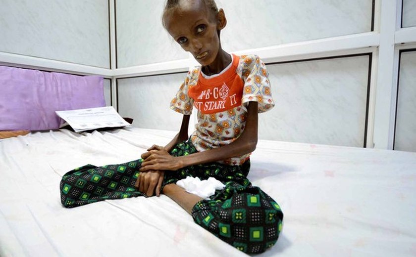 OMS estima que mais de 7 mil morreram na guerra do Iêmen
