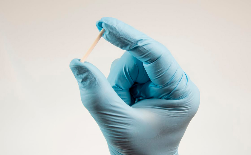 SUS vai oferecer implante contraceptivo de longa duração a partir do segundo semestre
