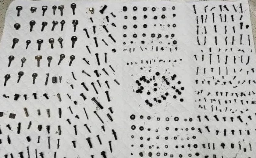 Médicos no Irã removem 452 objetos de metal do estômago de homem