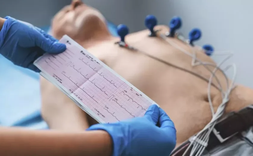 Unidades de Referência realizaram desde maio de 2023 mais de 4.500 eletrocardiogramas