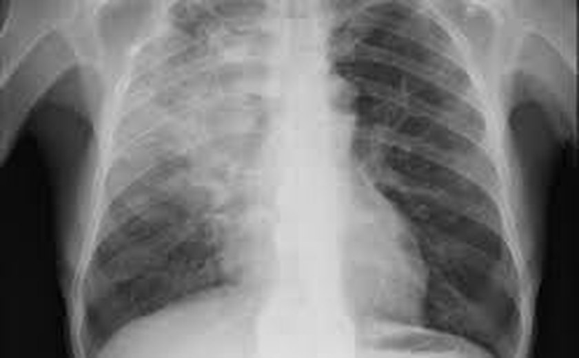 Pneumonia de causa misteriosa se espalha entre cães e alerta autoridades de saúde nos EUA