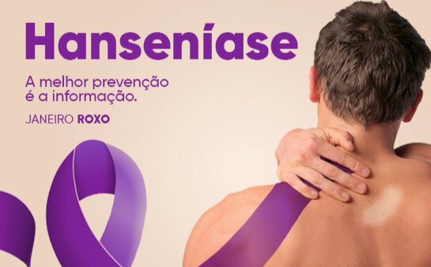 Janeiro Roxo em Alagoas: Sesau promove eventos para conscientização e combate à Hanseníase