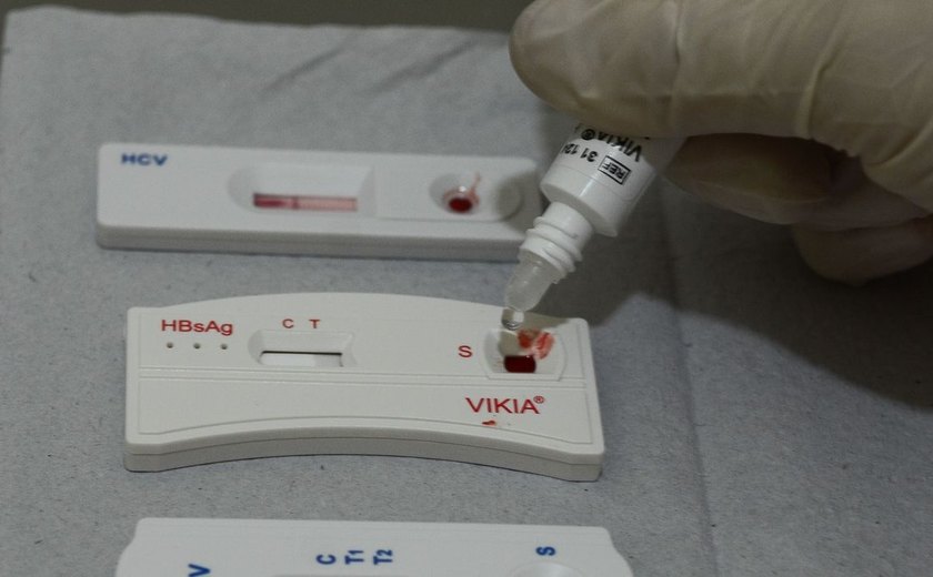 SP tem 30 mil cadastrados para profilaxia pré-exposição ao HIV