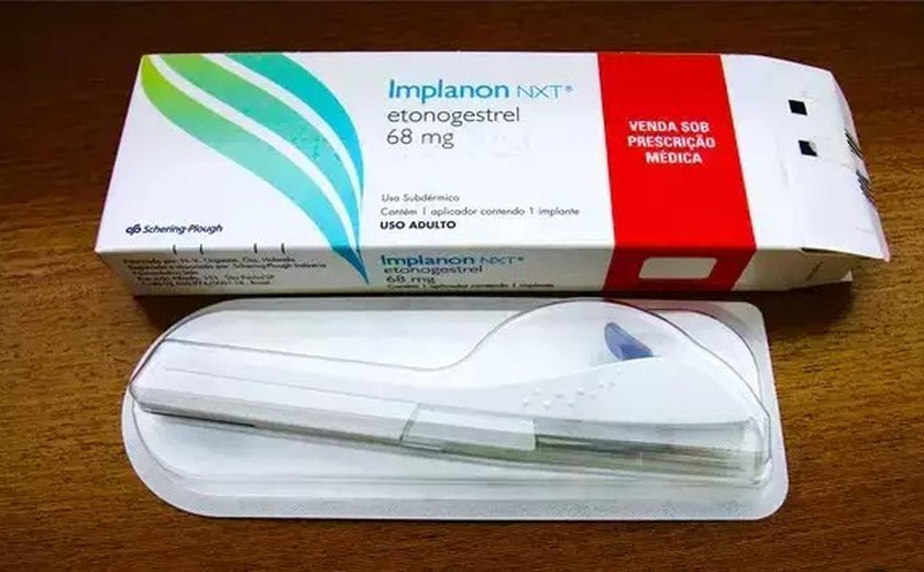 Planos de saúde passam a oferecer implante contraceptivo Implanon