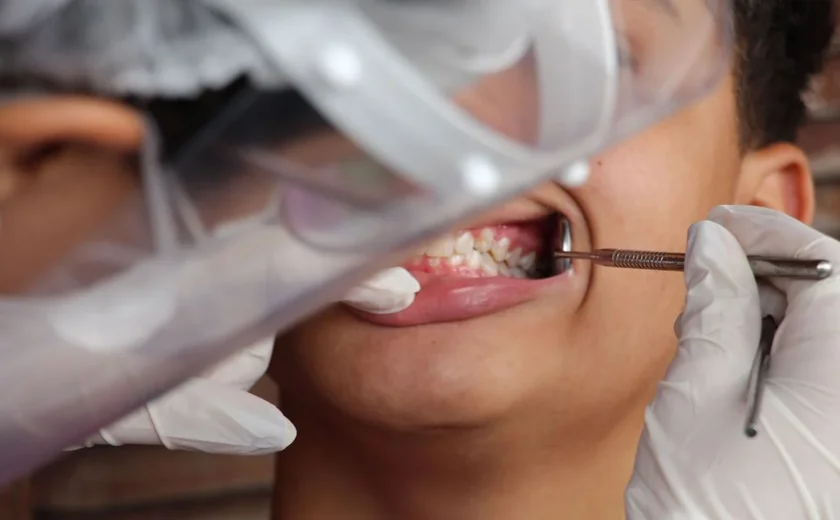 'Ranjo tanto os dentes que eles estão começando a desaparecer', diz mulher que sofre de bruxismo há mais de 10 anos