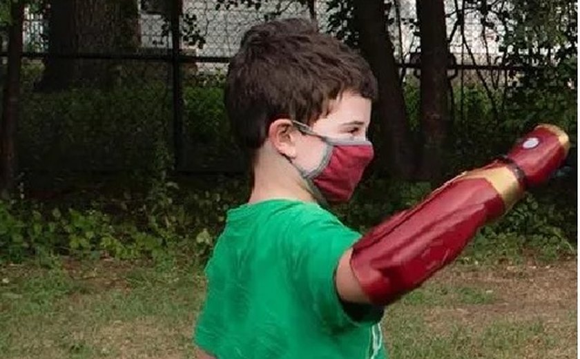 Menino de 7 anos recebe doação de braço biônico do 'Homem de Ferro'