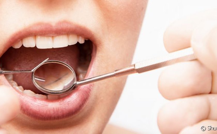 Abrasão dental: entenda o desgaste progressivo e suas consequências para a saúde bucal