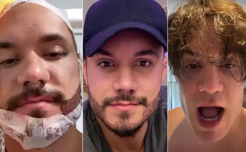 Após transplante avaliado em R$ 18 mil, Eliezer abre mão de barba por causa filha; entenda