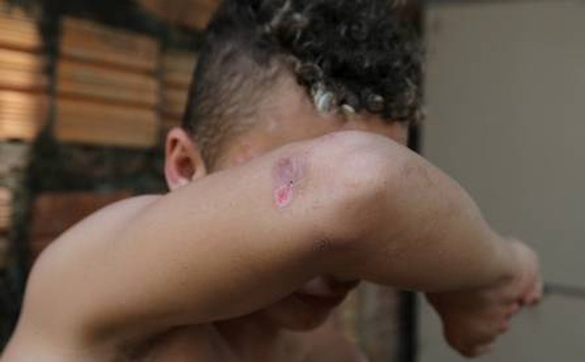 Menor que sobreviveu a linchamento no Maranhão mostra ferimentos e diz que foi reconhecido por vizinho