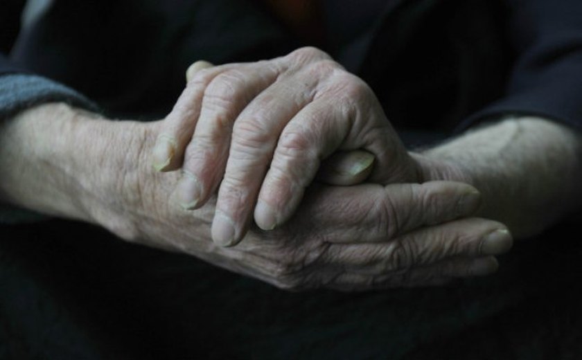 Pacientes com Alzheimer contarão com novo medicamento no SUS
