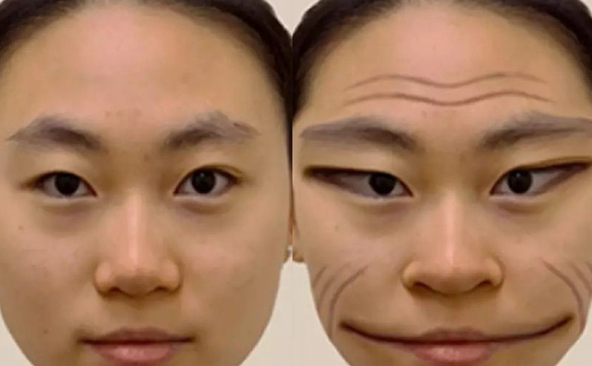 'Síndrome da face demoníaca': Como é o rosto que a pessoa vê quando tem a doença?