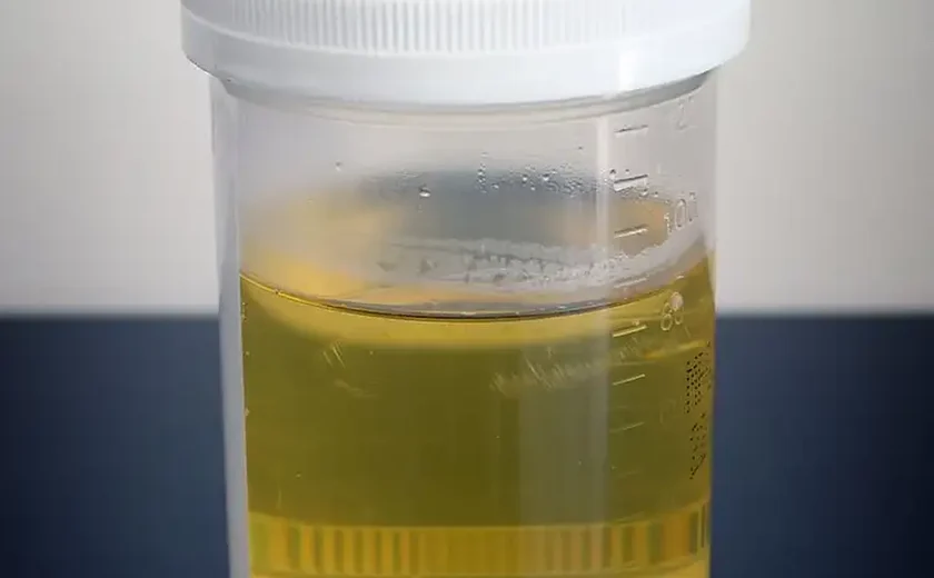 Coca-Cola, vinho rosé, tinto e 50 tons de amarelo: especialista explica o que significa as várias cores do xixi