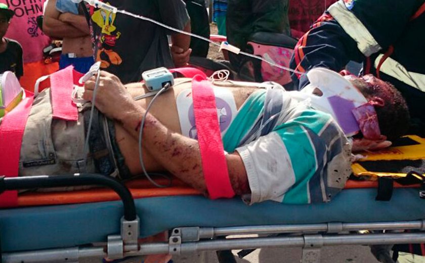 Ciclista atropelado na AL-220, em Arapiraca, morre na UE do Agreste