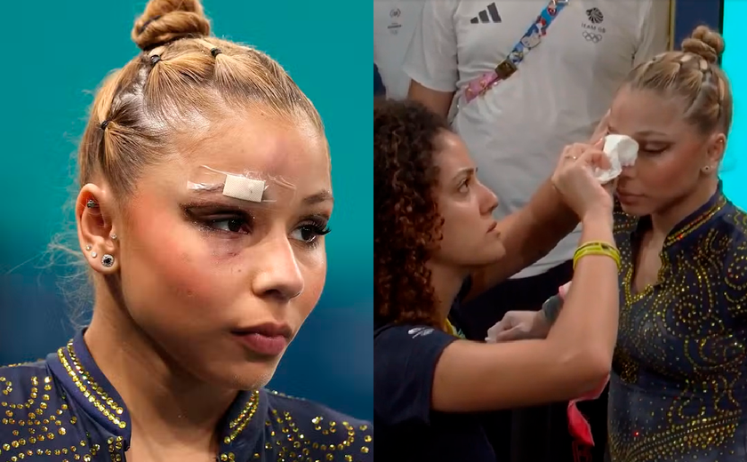 VÍDEO – Flavinha sofre queda, corta supercílio e se recupera na ginástica