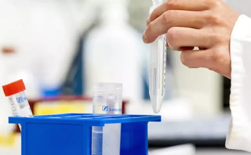 Italianos desenvolvem novo tratamento contra tumor cerebral