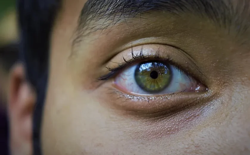 Qual a cor de olhos mais comum? E a mais rara?