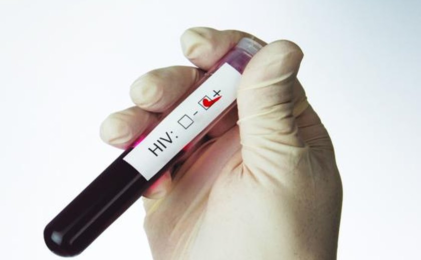 SUS terá teste rápido para aids feito com fluido oral em 2014