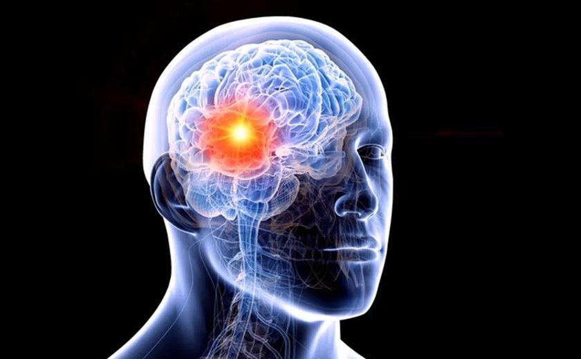Homem descobre tumor cerebral após beber 10 litros de água por dia