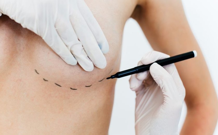 Nova lei amplia acesso a cirurgia reparadora de mama e apoio psicológico no SUS e em planos de saúde