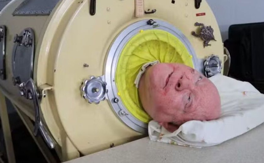 Último dos EUA com 'pulmão de ferro': entenda como homem viveu deitado em cápsula por 70 anos