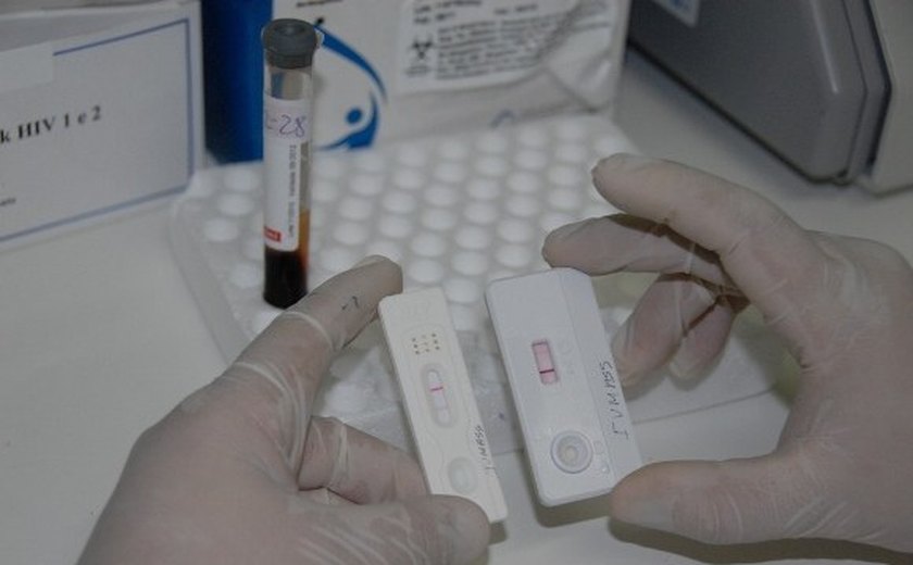 Saúde quer reverter quadro de infecção de DST/Aids em Unidades de Internação