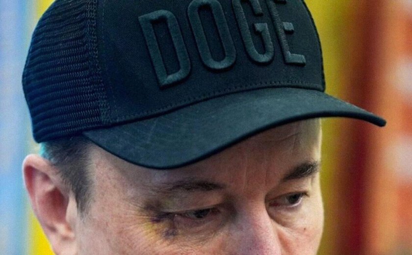 Musk aparece com hematoma no olho em cerimônia com Trump na Casa Branca