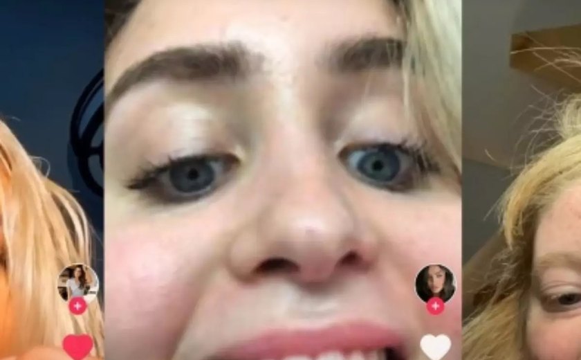 Abrir pacotes com os dentes pode causar rachaduras? Vídeo de dentista no TikTok viraliza com 3 ações que devem ser evitadas; confira