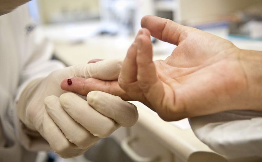 Justiça proíbe exigência de teste HIV para candidatos a concursos