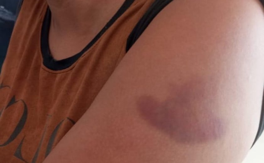 Homem é preso em Campo Alegre após agredir companheira com socos na cabeça