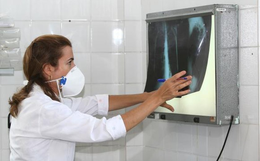 Tuberculose volta a crescer no Brasil e exige atenção