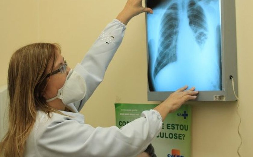 Brasil está na contramão da meta da OMS para extinção da tuberculose