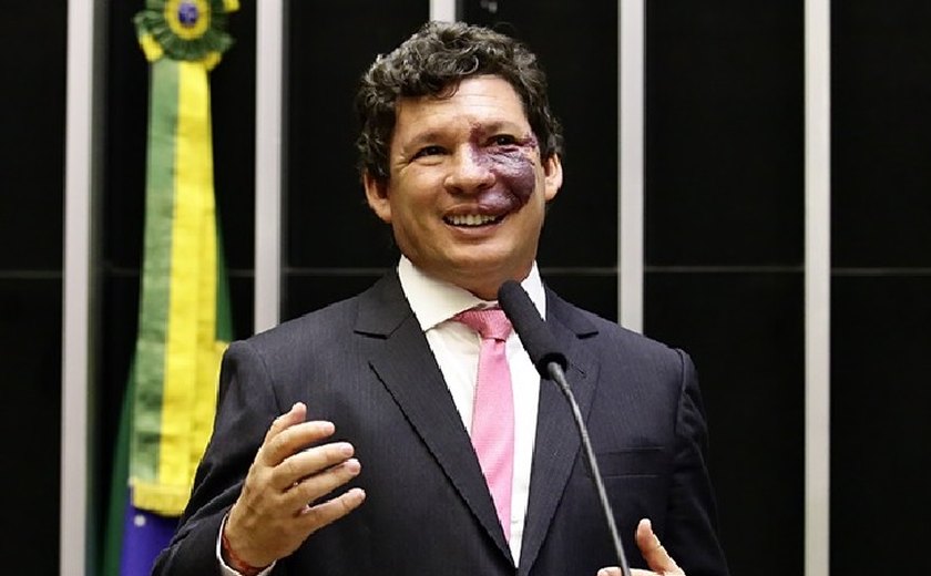 Reforma Tributária: deputados voltam a cogitar inclusão da carne na cesta básica